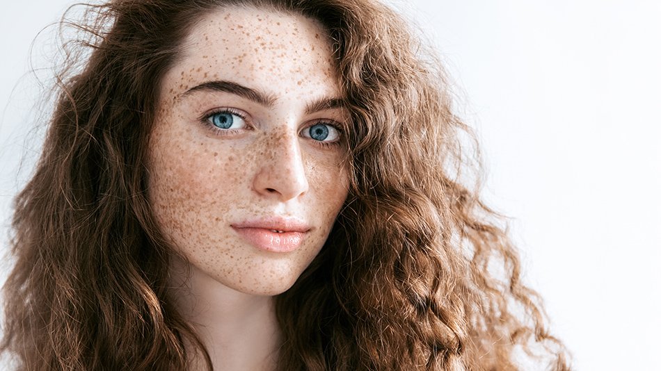 dziewczyna z piegami na skórze twarzy