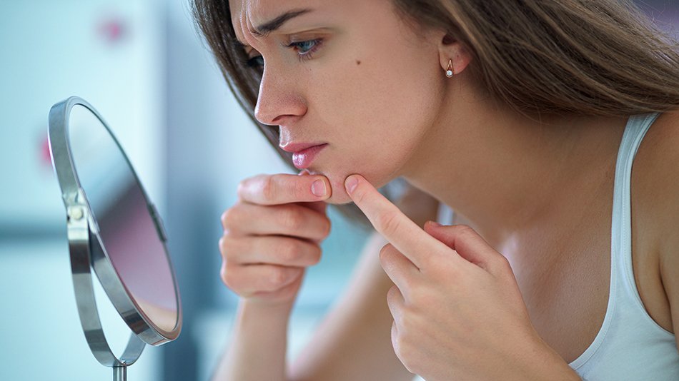 kobieta wyciskająca pryszcza