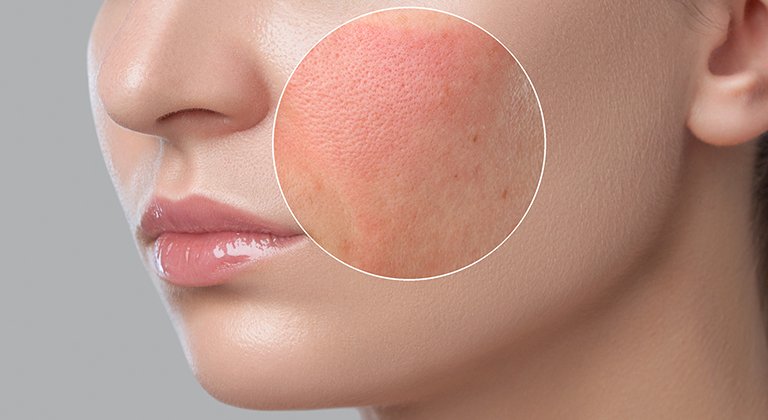 AdobeStock 331310259 768 x 420