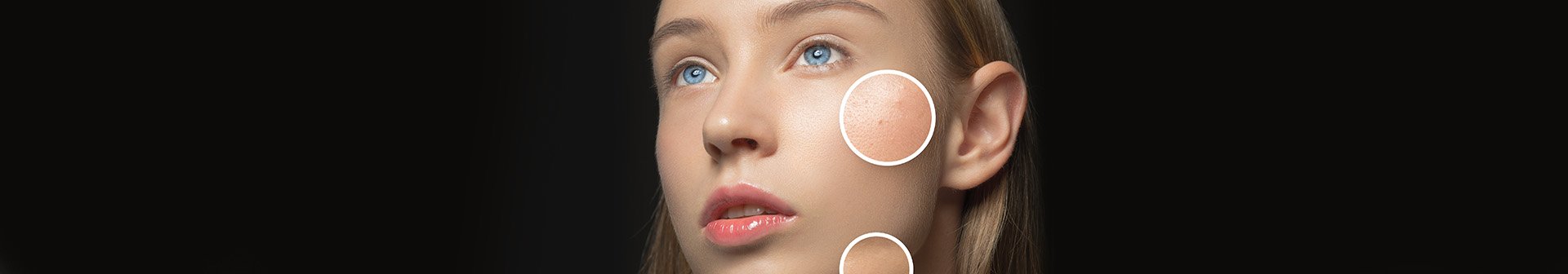 Przebarwienia skórne