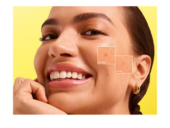 Vitamin C Serum na przebarwienia