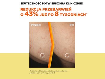 Garnier Vit C Serum 2 600x450